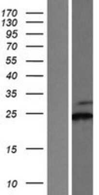 Western Blot: SSR2 Overexpression Lysate [NBP2-08032]