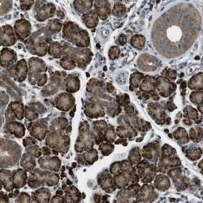 Immunohistochemistry-Paraffin: SSR3 Antibody [NBP1-80667]