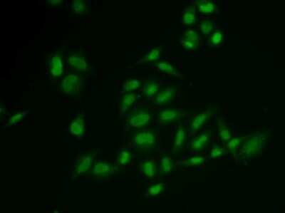 Immunocytochemistry/ Immunofluorescence: SSRP1 Antibody - Azide and BSA Free [NBP2-93977]