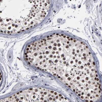Immunohistochemistry-Paraffin: SSRP1 Antibody [NBP1-84754]