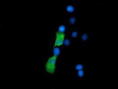Immunocytochemistry/ Immunofluorescence: SSSCA1 Antibody (OTI2F5) [NBP2-03198]
