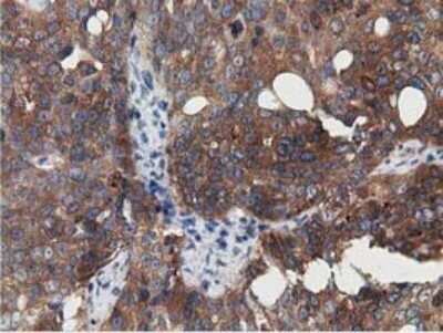 Immunohistochemistry-Paraffin: SSSCA1 Antibody (OTI2F5) [NBP2-03198]