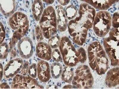 Immunohistochemistry-Paraffin: SSSCA1 Antibody (OTI2F5) [NBP2-03198]