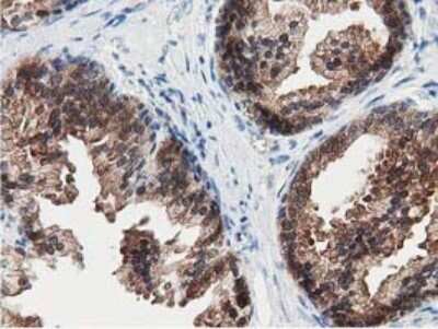 Immunohistochemistry-Paraffin: SSSCA1 Antibody (OTI2F5) [NBP2-03198]