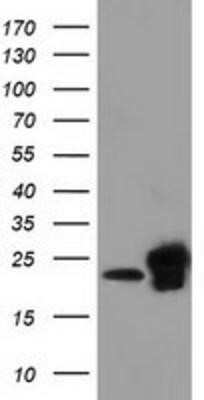 Western Blot: SSSCA1 Antibody (OTI2F5) [NBP2-03198]