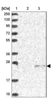 Western Blot: SSSCA1 Antibody [NBP2-13387]