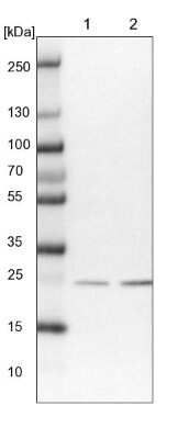 Western Blot: SSSCA1 Antibody [NBP2-13387]