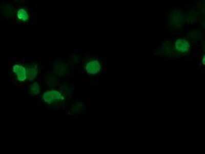 Immunocytochemistry/ Immunofluorescence: SSX1 Antibody (OTI1E10) - Azide and BSA Free [NBP2-74362]