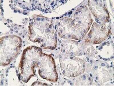 Immunohistochemistry-Paraffin: SSX1 Antibody (OTI1E10) [NBP2-00614]