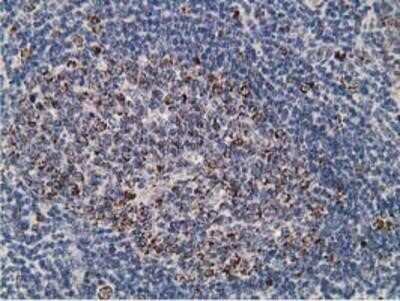 Immunohistochemistry-Paraffin: SSX1 Antibody (OTI1E10) [NBP2-00614]