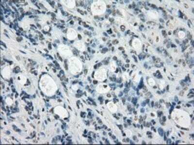 Immunohistochemistry-Paraffin: SSX2 Antibody (OTI4D10) [NBP1-48008]