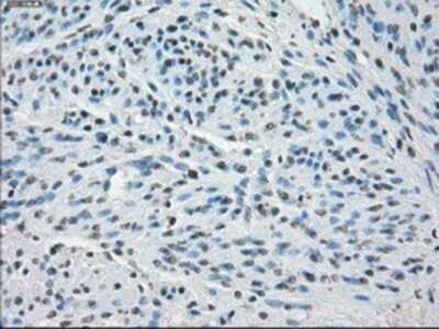 Immunohistochemistry-Paraffin: SSX2 Antibody (OTI4D10) [NBP1-48008]