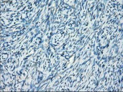 Immunohistochemistry-Paraffin: SSX2 Antibody (OTI4D10) [NBP1-48008]