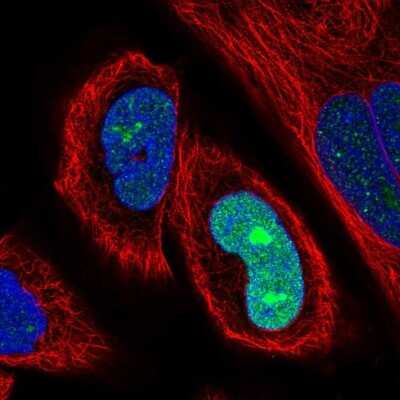 Immunocytochemistry/ Immunofluorescence: SSX2 Antibody [NBP2-46717]