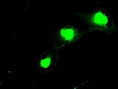 Immunocytochemistry/ Immunofluorescence: SSX2 Antibody (OTI4D10) - Azide and BSA Free [NBP2-74368]