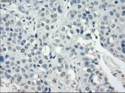 Immunohistochemistry: SSX2 Antibody (OTI4D10) - Azide and BSA Free [NBP2-74368]