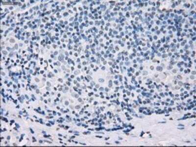 Immunohistochemistry: SSX2 Antibody (OTI4D10) - Azide and BSA Free [NBP2-74368]