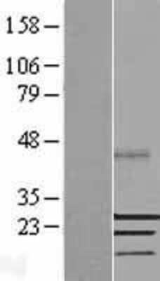 Western Blot: SSX2 Overexpression Lysate [NBL1-16484]