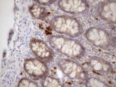 Immunohistochemistry: SSX2IP Antibody (OTI5C3) [NBP2-45458]