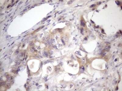 Immunohistochemistry: SSX2IP Antibody (OTI5C3) [NBP2-45458]