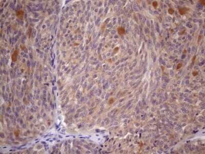 Immunohistochemistry: SSX2IP Antibody (OTI5C3) [NBP2-45458]