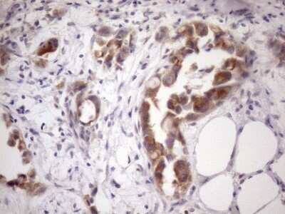 Immunohistochemistry: SSX2IP Antibody (OTI5C3) [NBP2-45458]