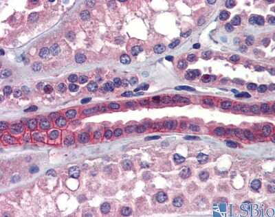 Immunohistochemistry: SSX2IP Antibody [NBP1-59113]