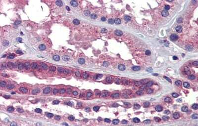 Immunohistochemistry-Paraffin: SSX2IP Antibody [NBP1-59113]