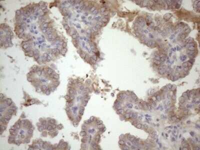 Immunohistochemistry: SSX2IP Antibody (OTI5C3) - Azide and BSA Free [NBP2-74369]