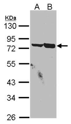 Western Blot: SSX2IP Antibody [NBP1-30987]