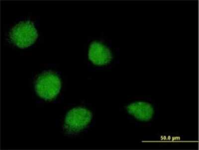 Immunocytochemistry/ Immunofluorescence: SSX4 Antibody (3E10) [H00006759-M02]