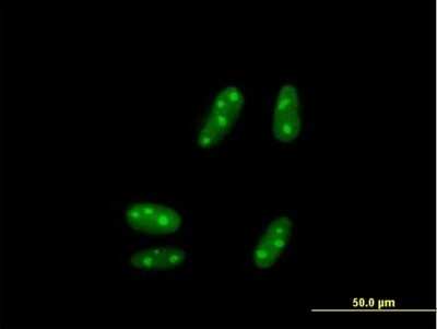 Immunocytochemistry/ Immunofluorescence: SSX5 Antibody [H00006758-B01P]