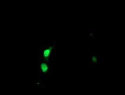 Immunocytochemistry/ Immunofluorescence: SSX5 Antibody (OTI3G6) - Azide and BSA Free [NBP2-74372]