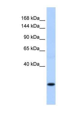 Western Blot: SSX8 Antibody [NBP1-79469]