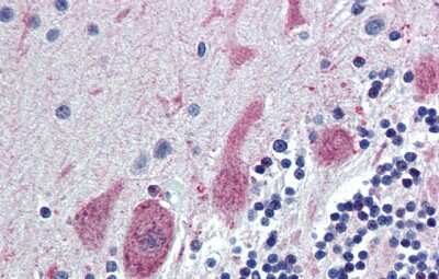 Immunohistochemistry: ST18 Antibody [NBP2-85825]