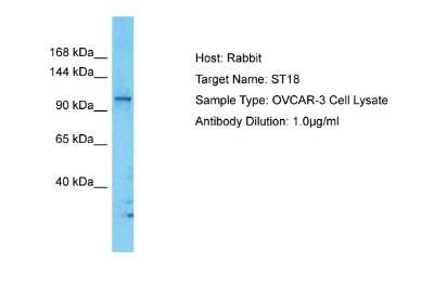 Western Blot: ST18 Antibody [NBP2-85825]