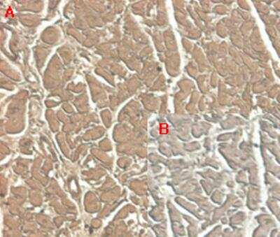 Immunohistochemistry: ST2/IL-33R Antibody (ST33868) - Azide and BSA Free [NBP2-80040]