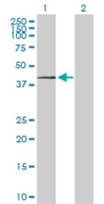 Western Blot: ST3 beta-Gal alpha-2,3-Sialyltransferase 1/ST3GAL1/SIAT4A Antibody [H00006482-D01P]