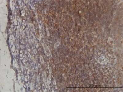 Immunohistochemistry-Paraffin: ST3 beta-Gal alpha-2,3-Sialyltransferase 2/ST3GAL2 Antibody (1E12) [H00006483-M01]