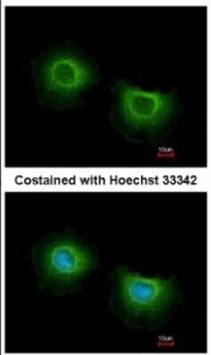 Immunocytochemistry/ Immunofluorescence: ST3GAL3 Antibody [NBP2-20491]