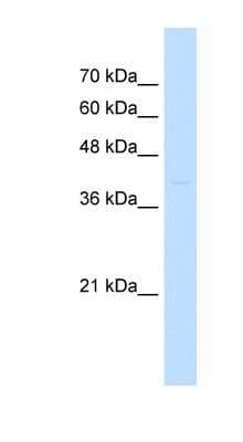 Western Blot: ST3GAL3 Antibody [NBP1-62554]