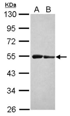Western Blot: ST3GAL3 Antibody [NBP2-20491]