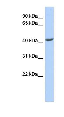 Western Blot: ST3GAL4 Antibody [NBP1-62481]