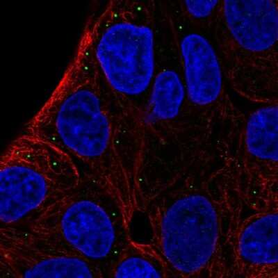 Immunocytochemistry/ Immunofluorescence: ST3GAL5 Antibody [NBP2-56522]