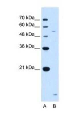 Western Blot: ST3GAL5 Antibody [NBP1-62444]
