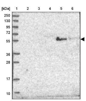 Western Blot: ST3GAL5 Antibody [NBP2-32612]