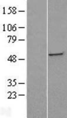 Western Blot: ST3GAL5 Overexpression Lysate [NBL1-16493]