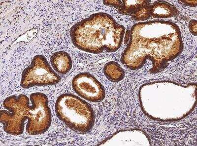 Immunohistochemistry-Paraffin: ST6 Gal Sialyltransferase 1/ST6GAL1/CD75 Antibody (036) [NBP2-89923]