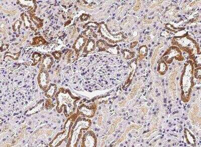 Immunohistochemistry-Paraffin: ST6 Gal Sialyltransferase 1/ST6GAL1/CD75 Antibody (036) [NBP2-89923]