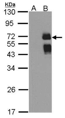 Western Blot: ST6 Gal Sialyltransferase 1/ST6GAL1/CD75 Antibody [NBP2-15817]